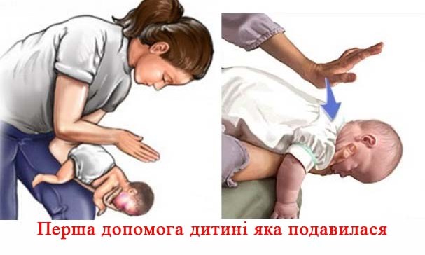 yrpmasvchiu3ts-1