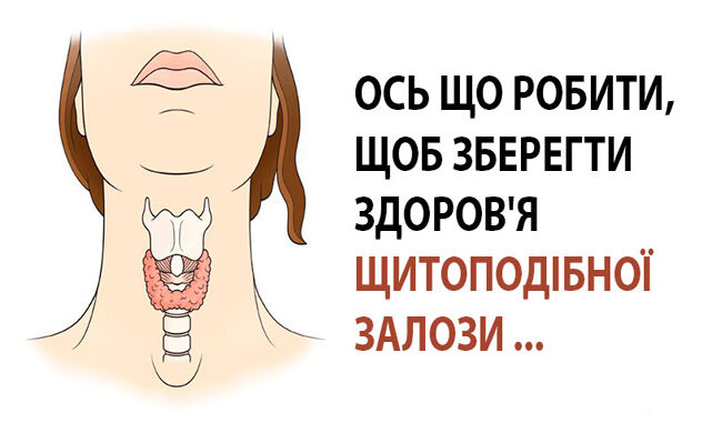 shchytovydka-2-632x381-1
